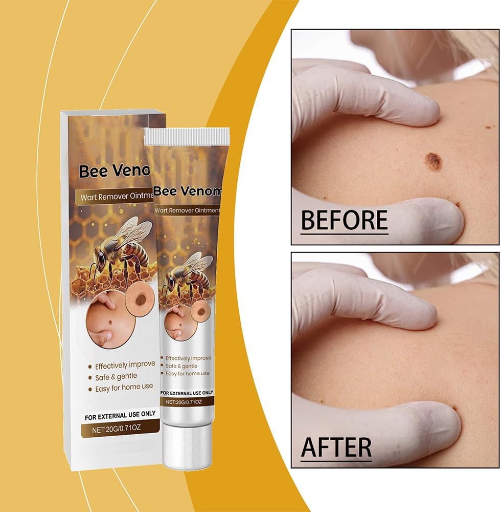 Sumifun Bee Venom Wart Remover Ointment Clearance, Safe Gentle Skin Tag Mole Removal Cream, 20g Natural Skin Care Topical Gel for Home Use