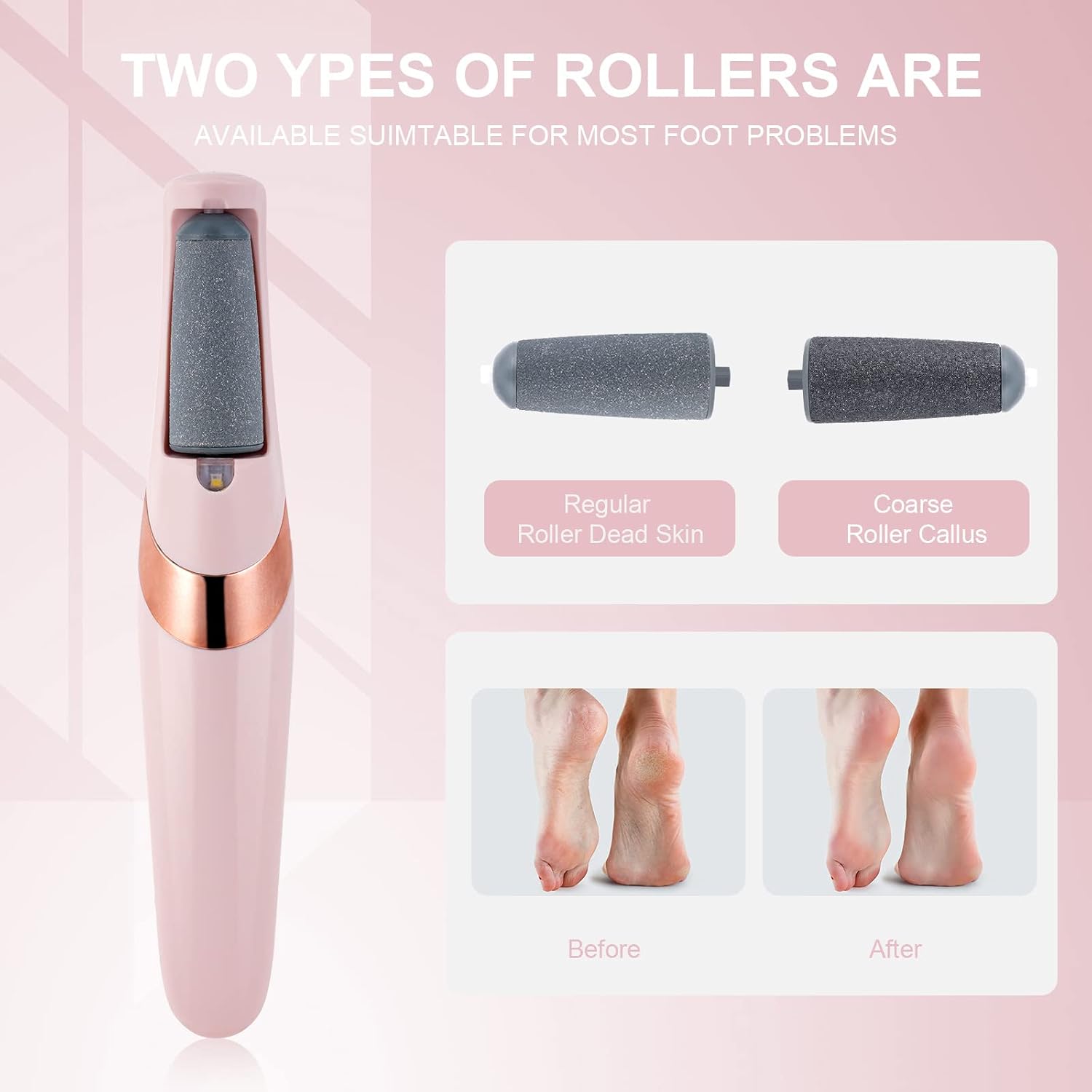 Rechargeable Electric Foot Callus Remover Clearance, Dual Speed Pedicure Tool with 2 Replacement Roller Heads, USB Charging Dead Skin Hard Cracked Heel Foot File for Home Foot Spa