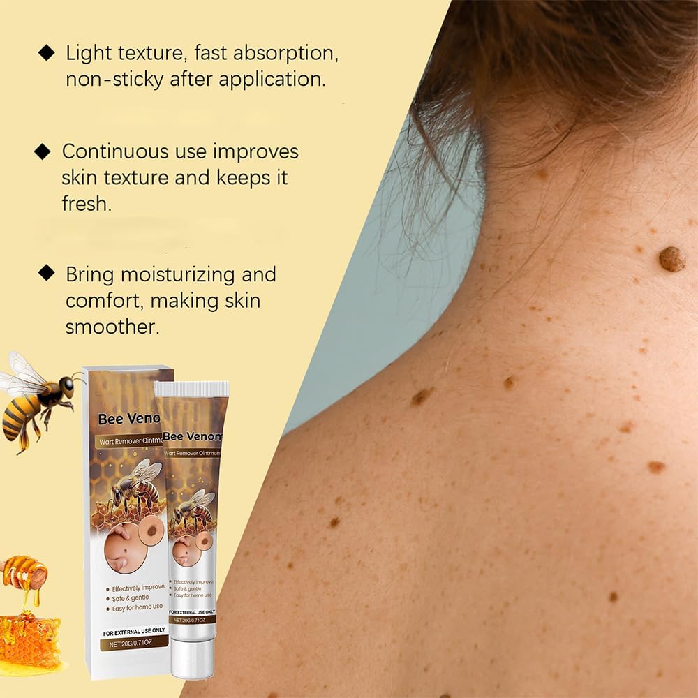 Sumifun Bee Venom Wart Remover Ointment Clearance, Safe Gentle Skin Tag Mole Removal Cream, 20g Natural Skin Care Topical Gel for Home Use