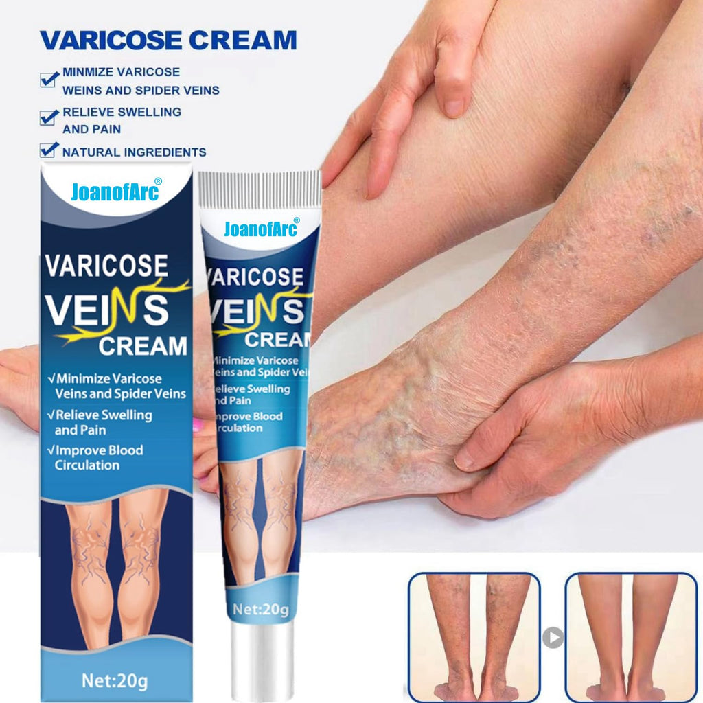 Bulk Liquidation Spider Vein Relief Massage Ointment Reduce Leg Swelling & Soreness, 99Pcs Whole Batch Leg Care Product