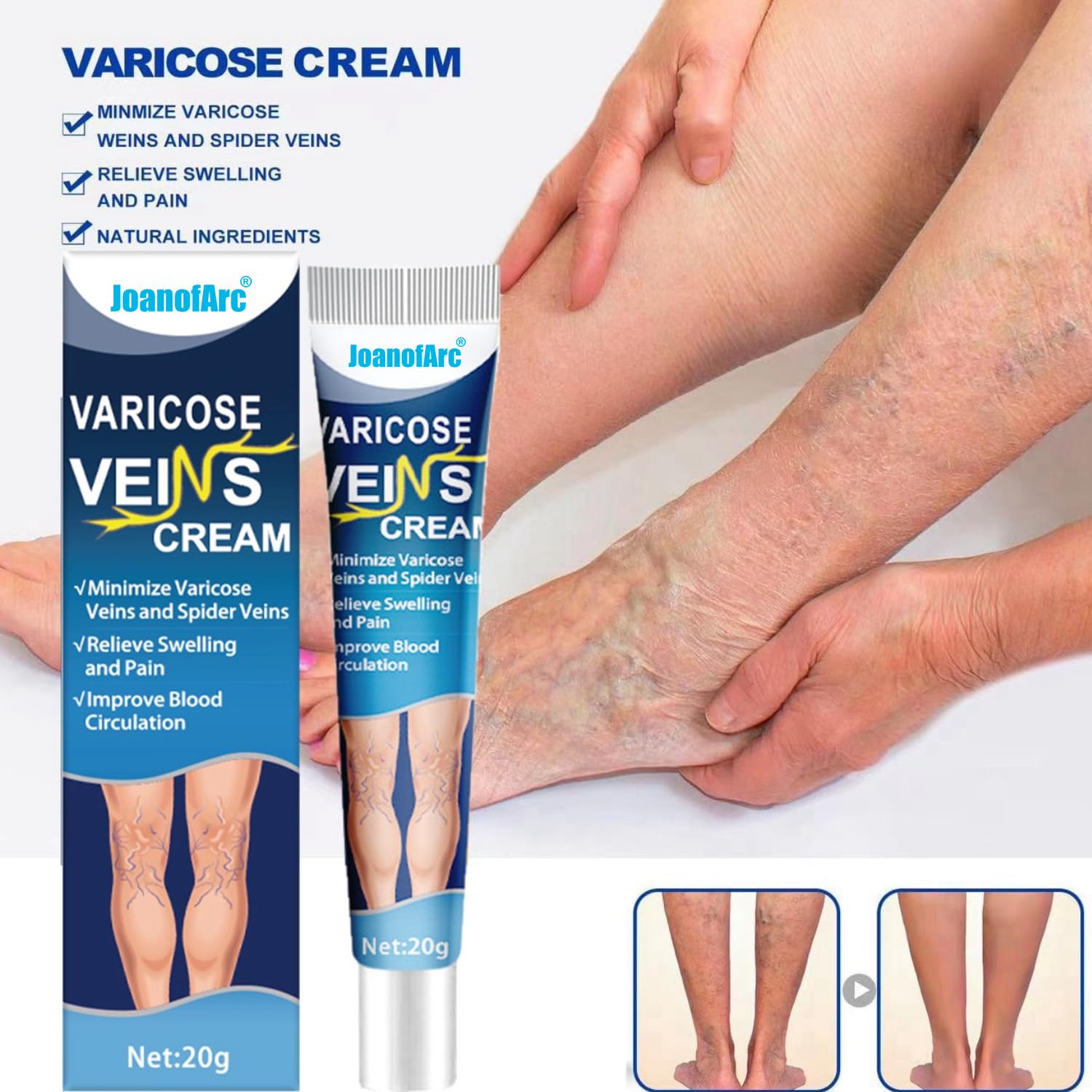 Bulk Liquidation Spider Vein Relief Massage Ointment Reduce Leg Swelling & Soreness, 99Pcs Whole Batch Leg Care Product