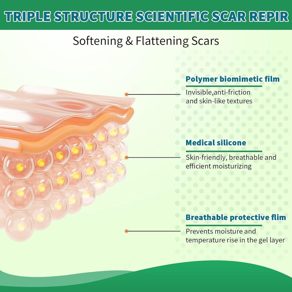 Bulk Liquidation Medical Grade Silicone Scar Tape, 10905 Rolls Mix Batch Reusable Stretch Mark Patch