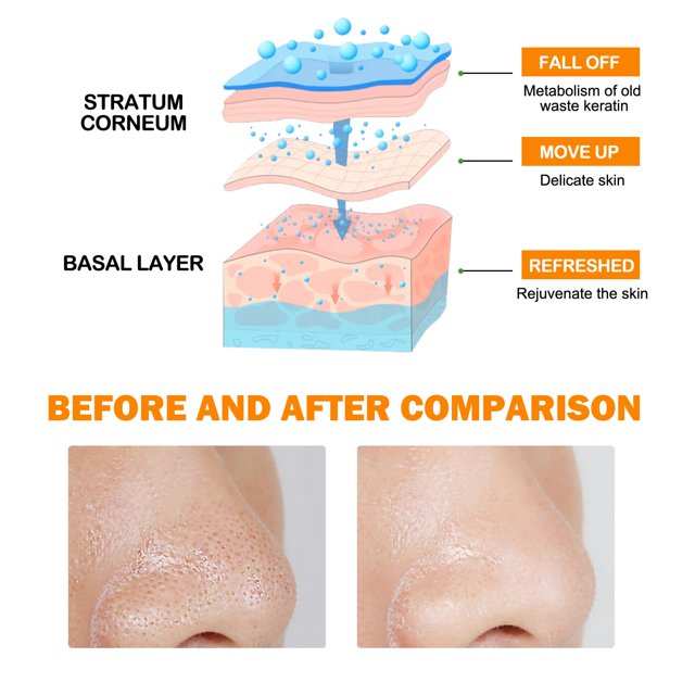 Clearance Orange Enzyme Exfoliating Gel, Mild Facial Dead Skin Remover Brightening Peeling Gel 50g